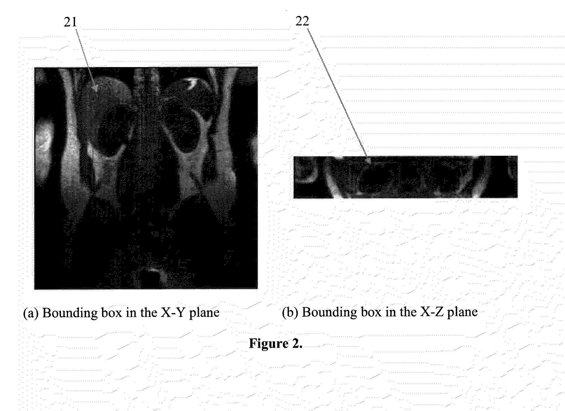 System and method for automatic registration of 4D (3D plus time) renal perfusion MRI data