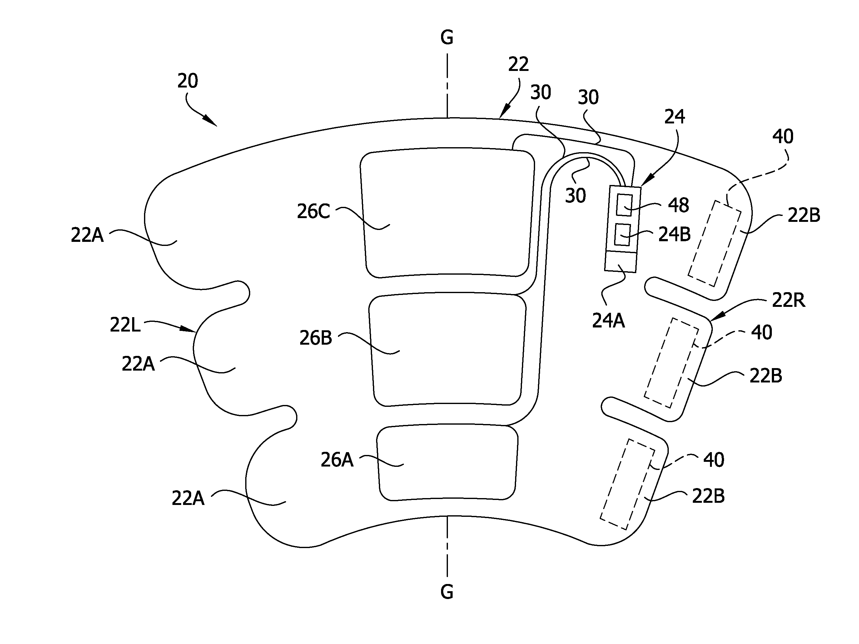 Compression garment apparatus having baseline pressure