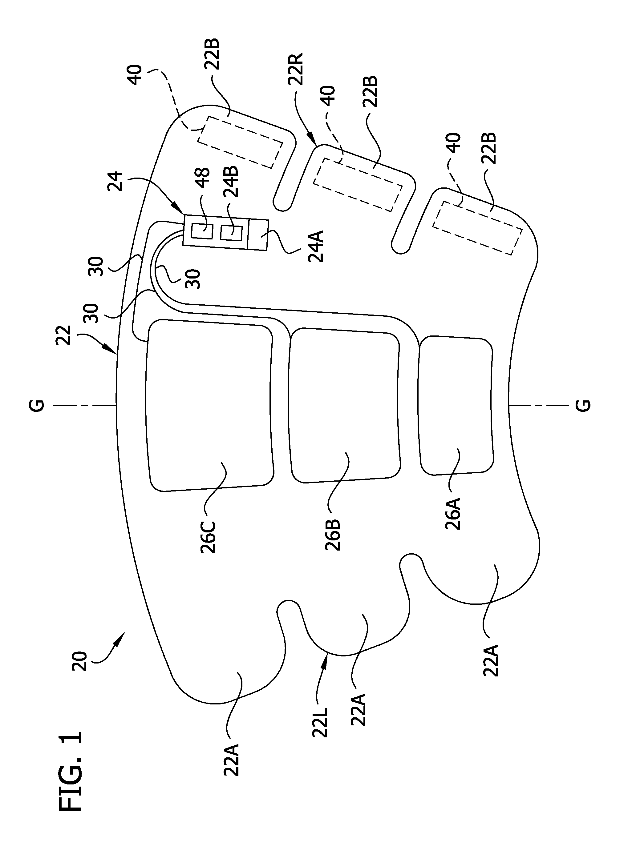 Compression garment apparatus having baseline pressure