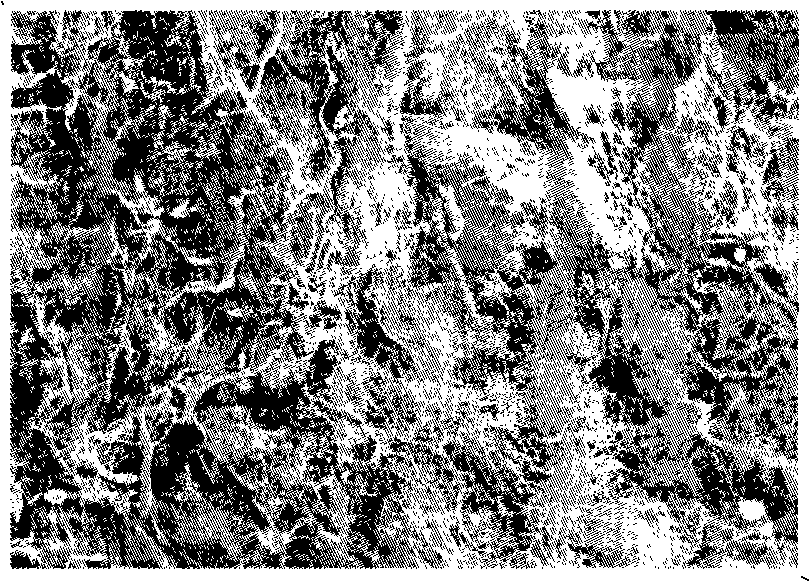 Double-layer collagen-chitosan sponges bracket and method of preparing the same