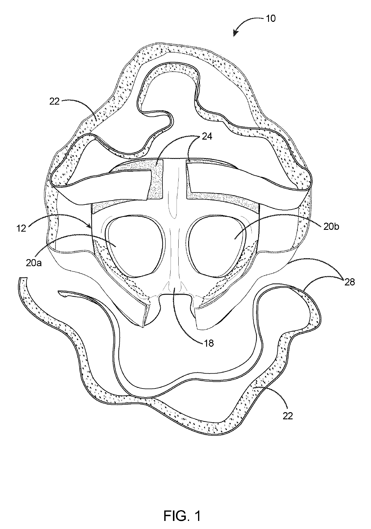 Face shield