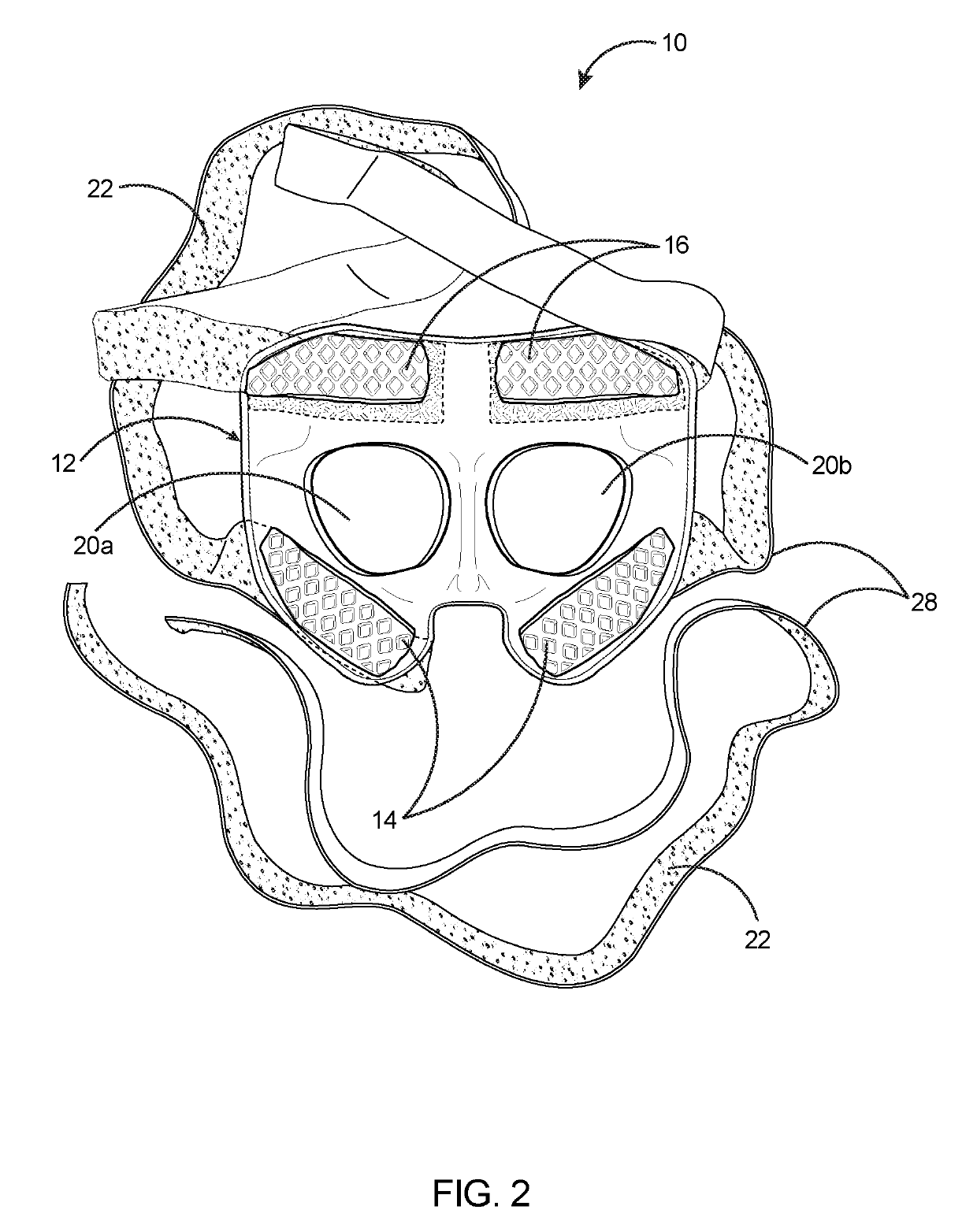 Face shield