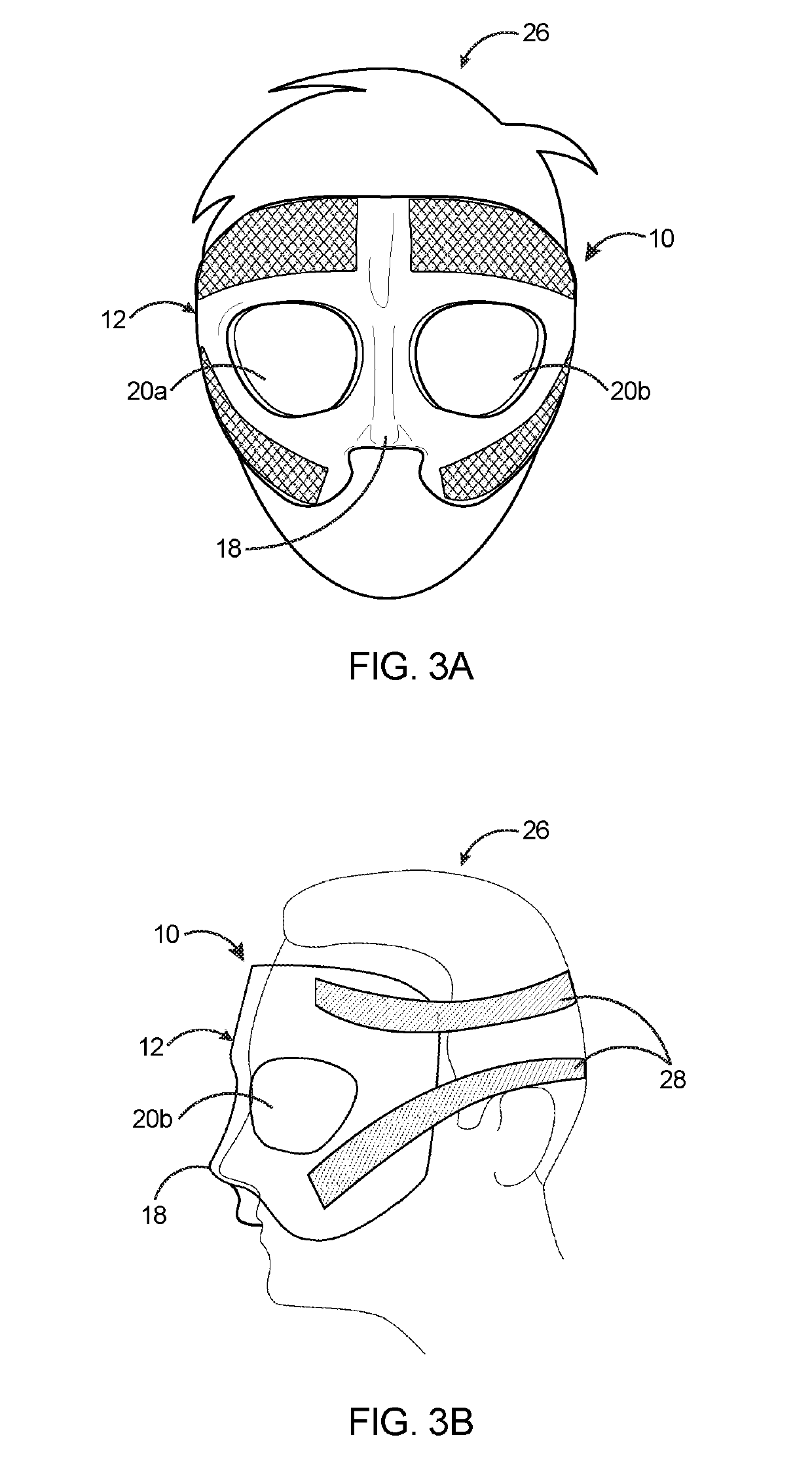 Face shield