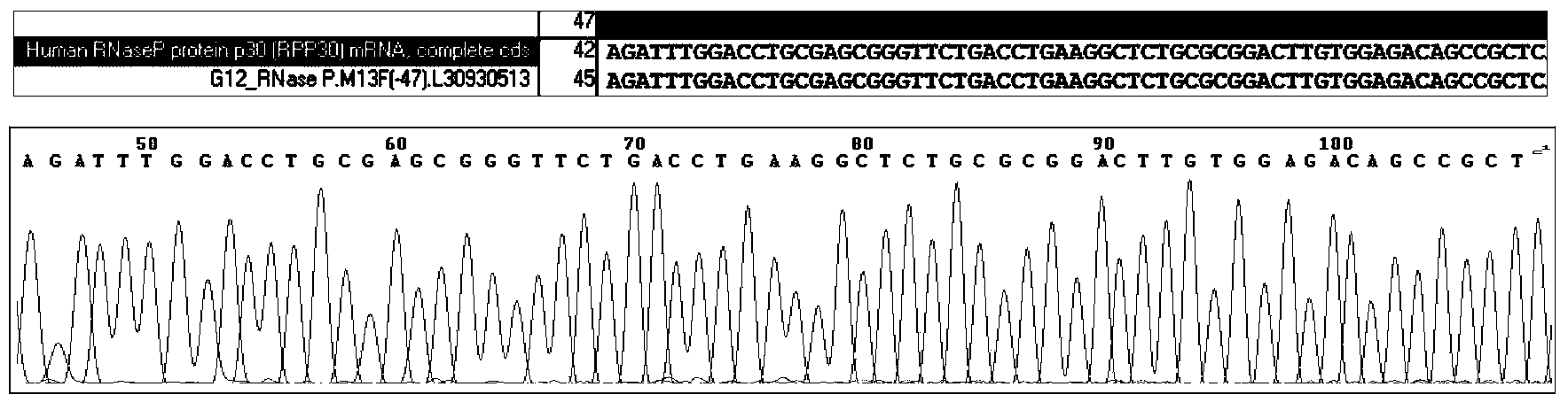 Gastric juice multiple real-time polymerase chain reaction (PCR) detection-based helicobacter pylori (HP) individualized treatment auxiliary diagnosis method