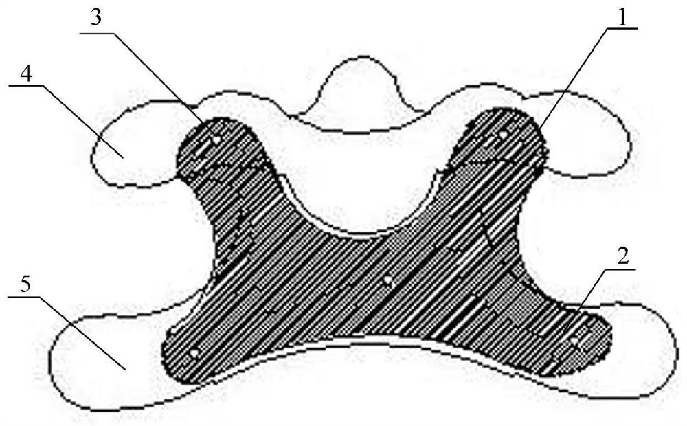 Anterior atlantoaxial fixation plate and preparation method thereof