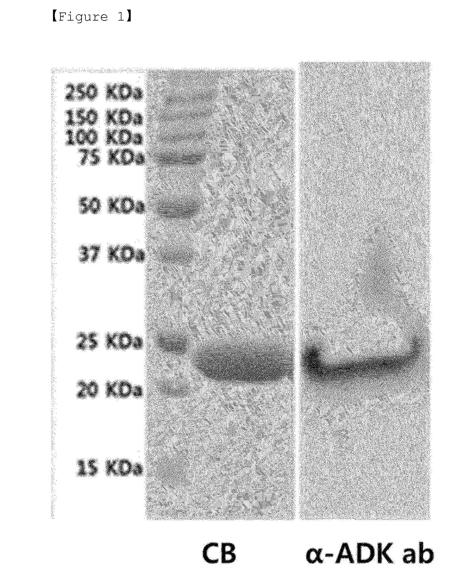 Composition for preventing or treating sepsis or septic shock comprising adk protein as active ingredient