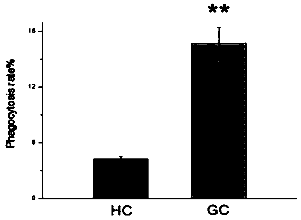 Screening method of stress-resistance portunus trituberculatus