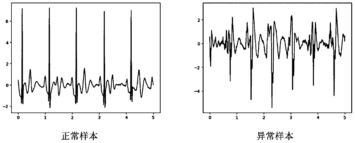 Electrocardiosignal detection device and analysis method based on joint neural network