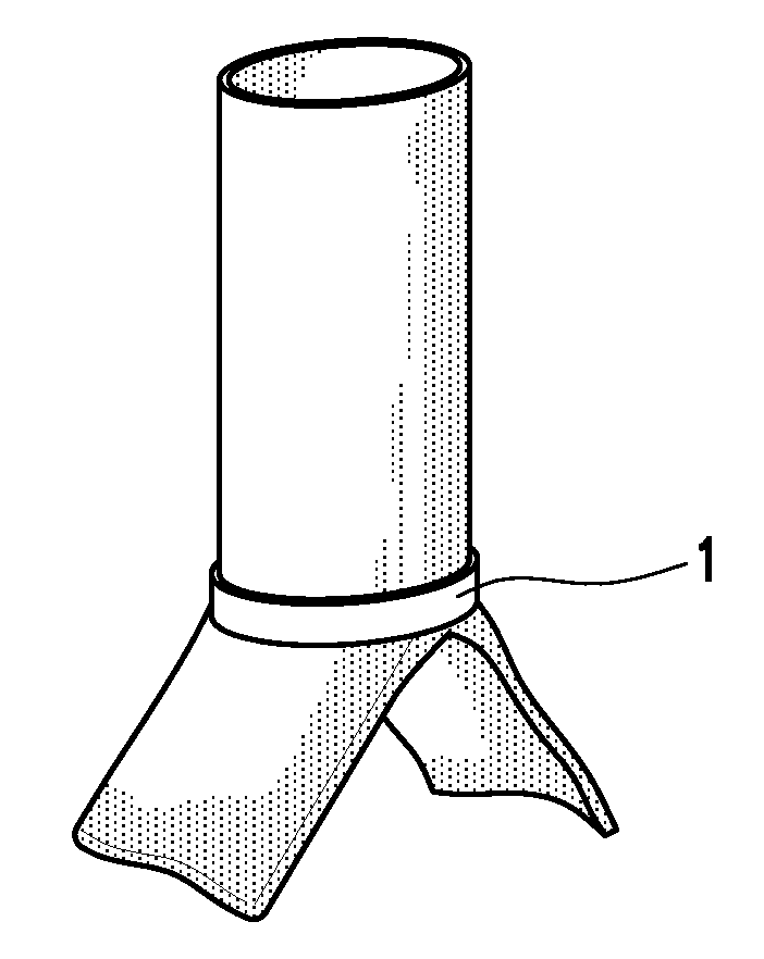 Device and method for joining vessels in anastomosis