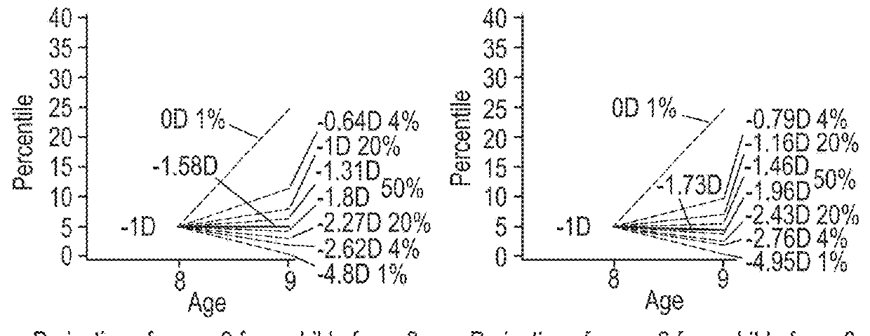 Ametropia treatment tracking methods and system