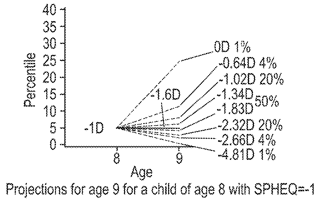 Ametropia treatment tracking methods and system