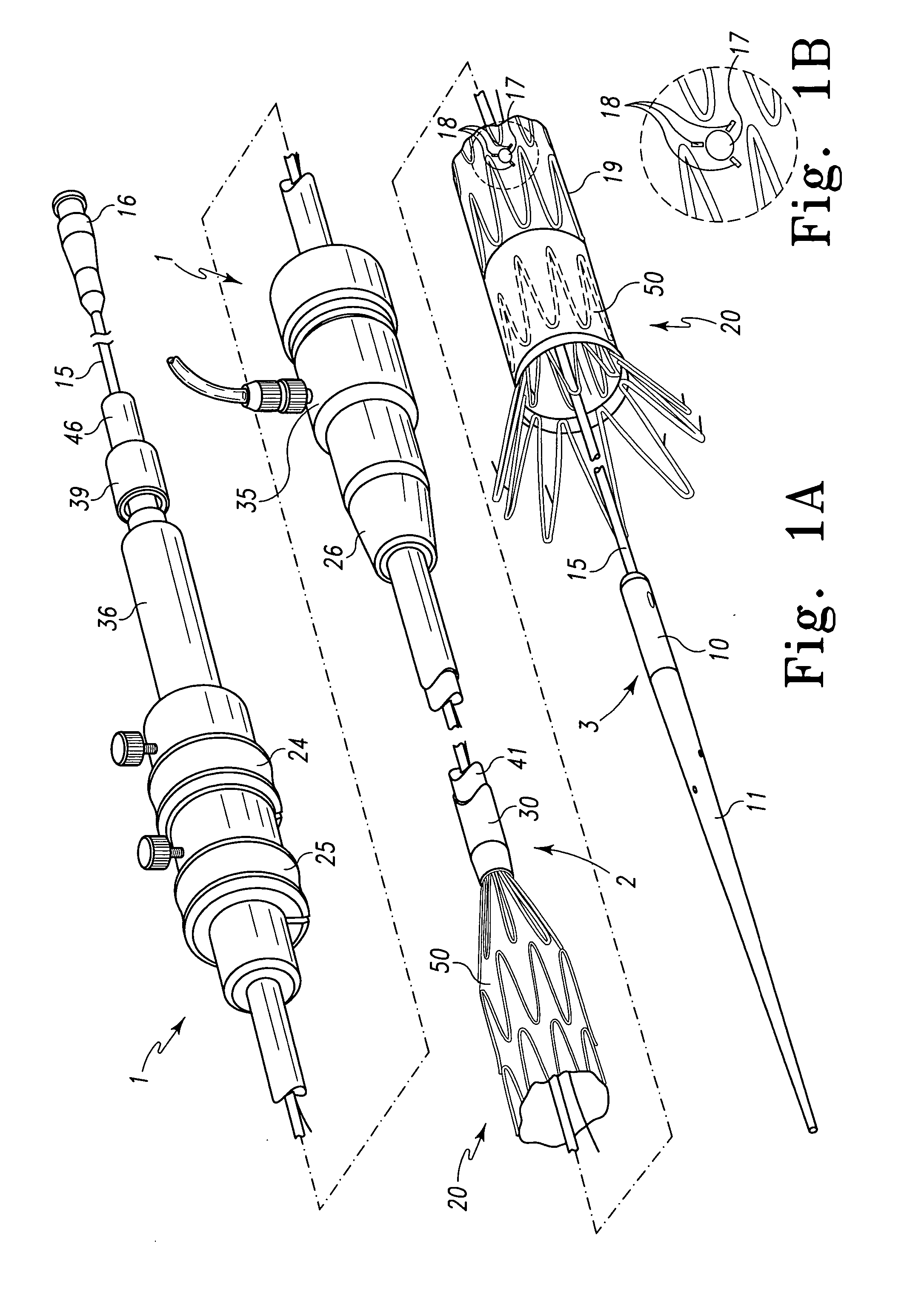 Fenestrated intraluminal stent system