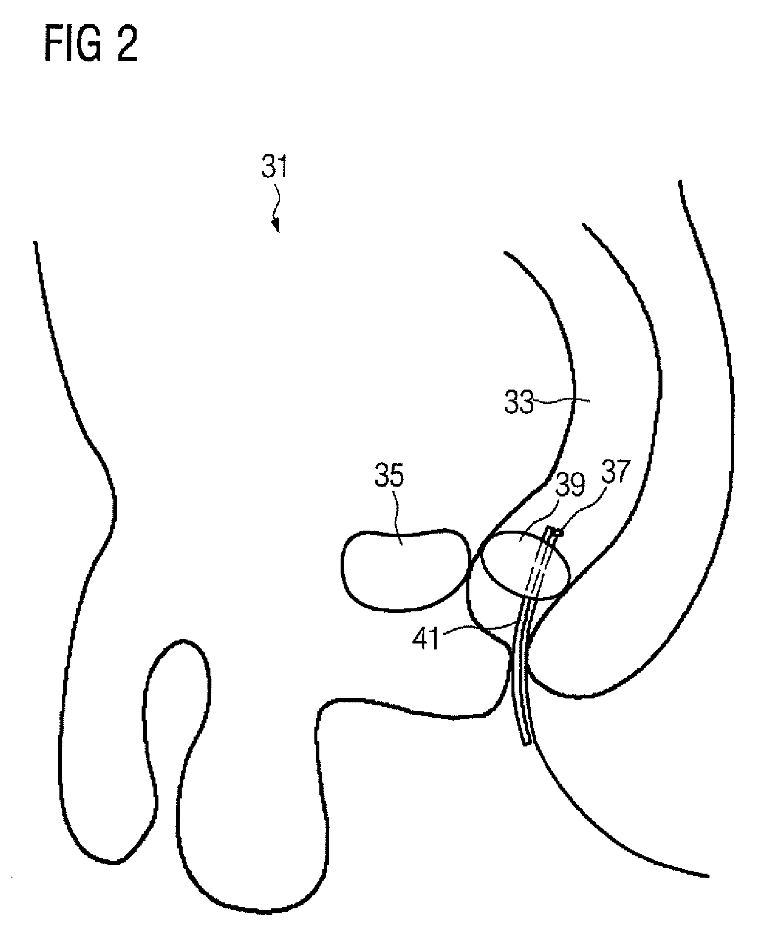 Control unit and method for controlling a radiation therapy system, and radiation therapy system