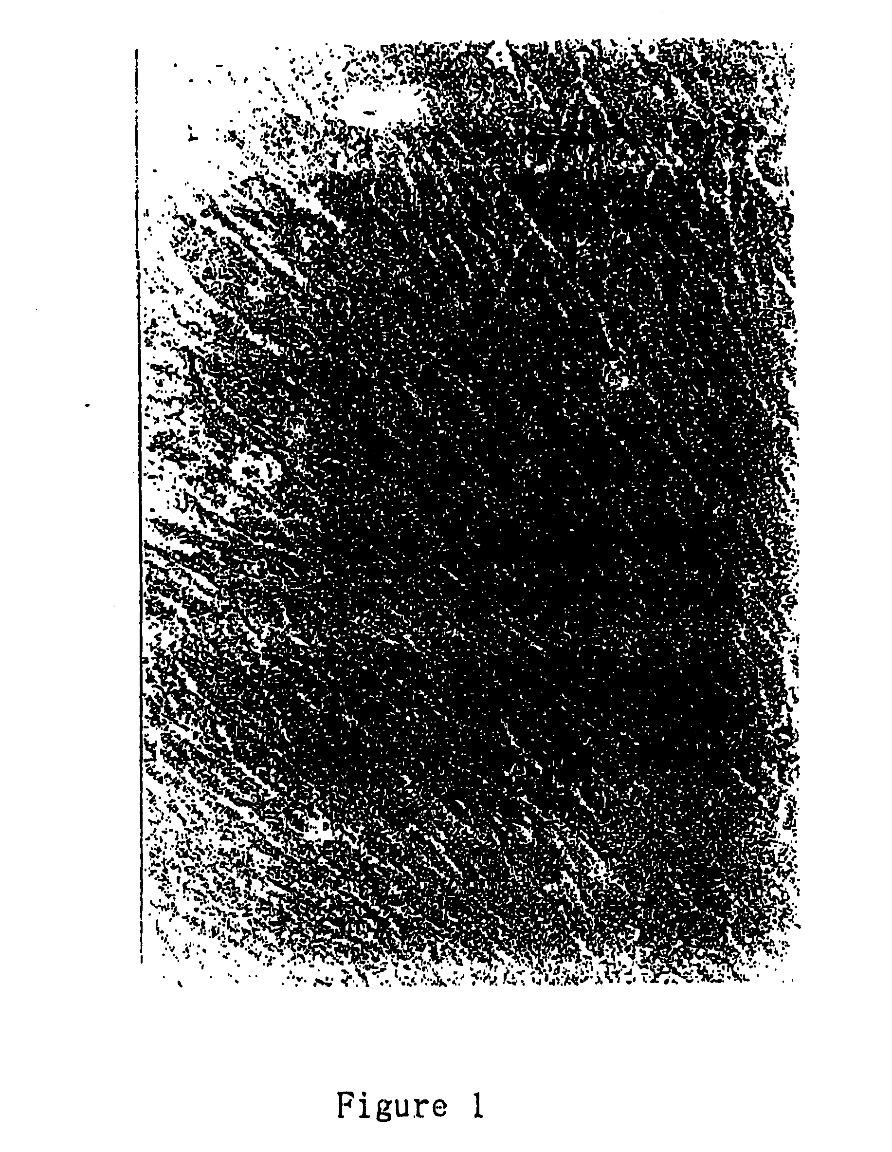 Somatic cell derived embryonic stem cells and its differentiated cells