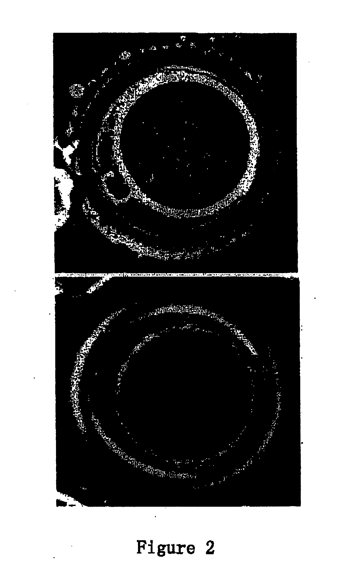 Somatic cell derived embryonic stem cells and its differentiated cells