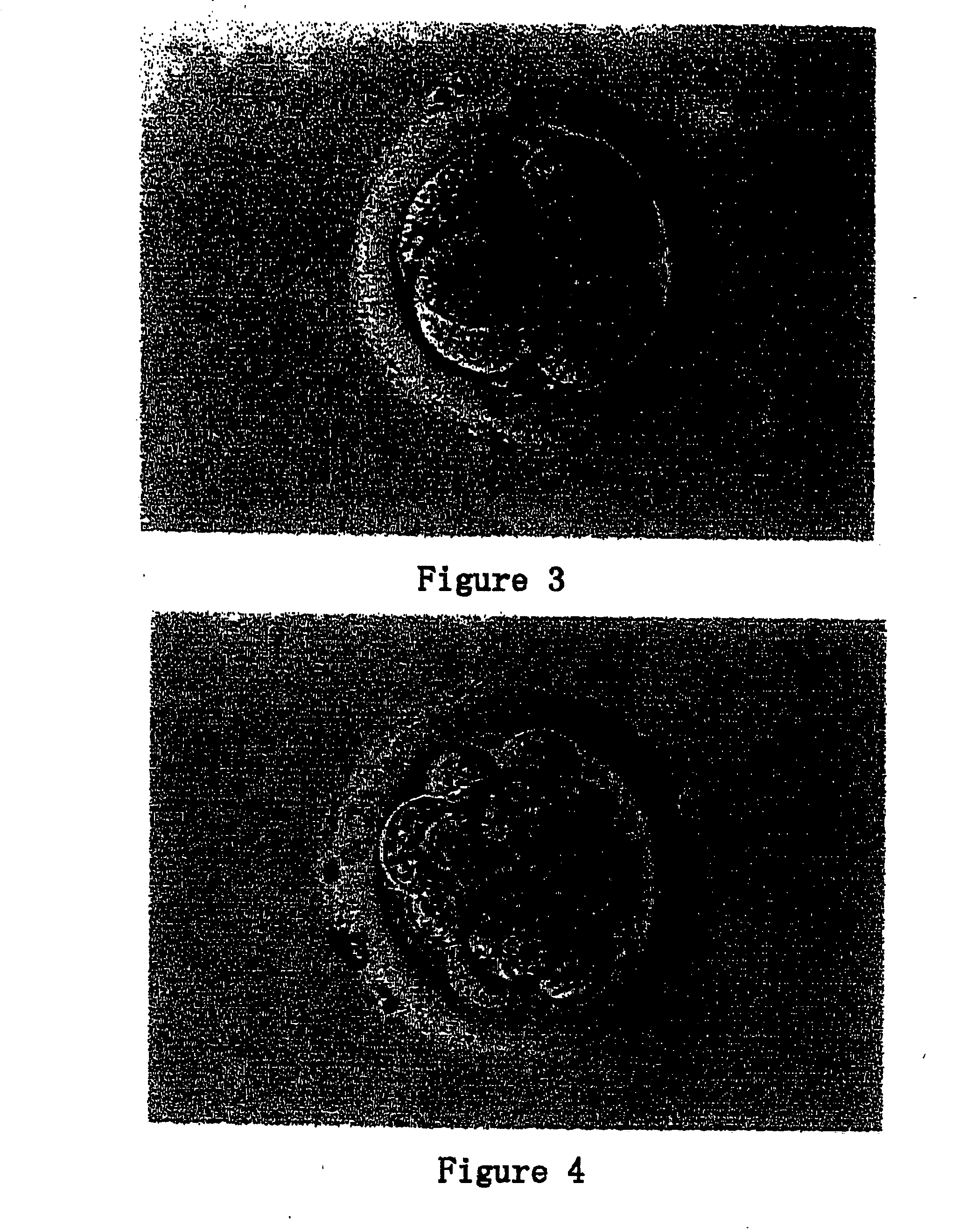 Somatic cell derived embryonic stem cells and its differentiated cells