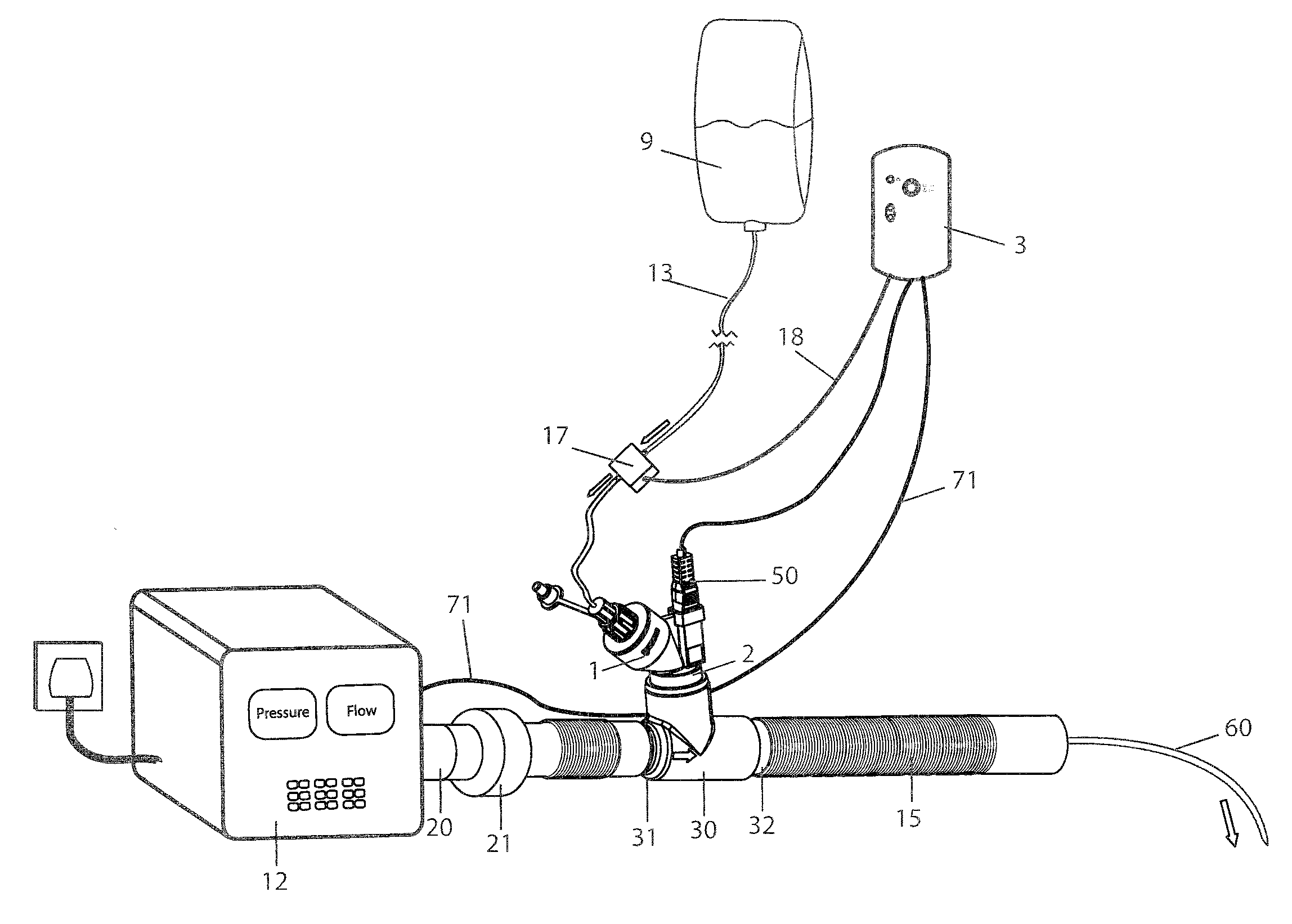 Insufflation of Body Cavities