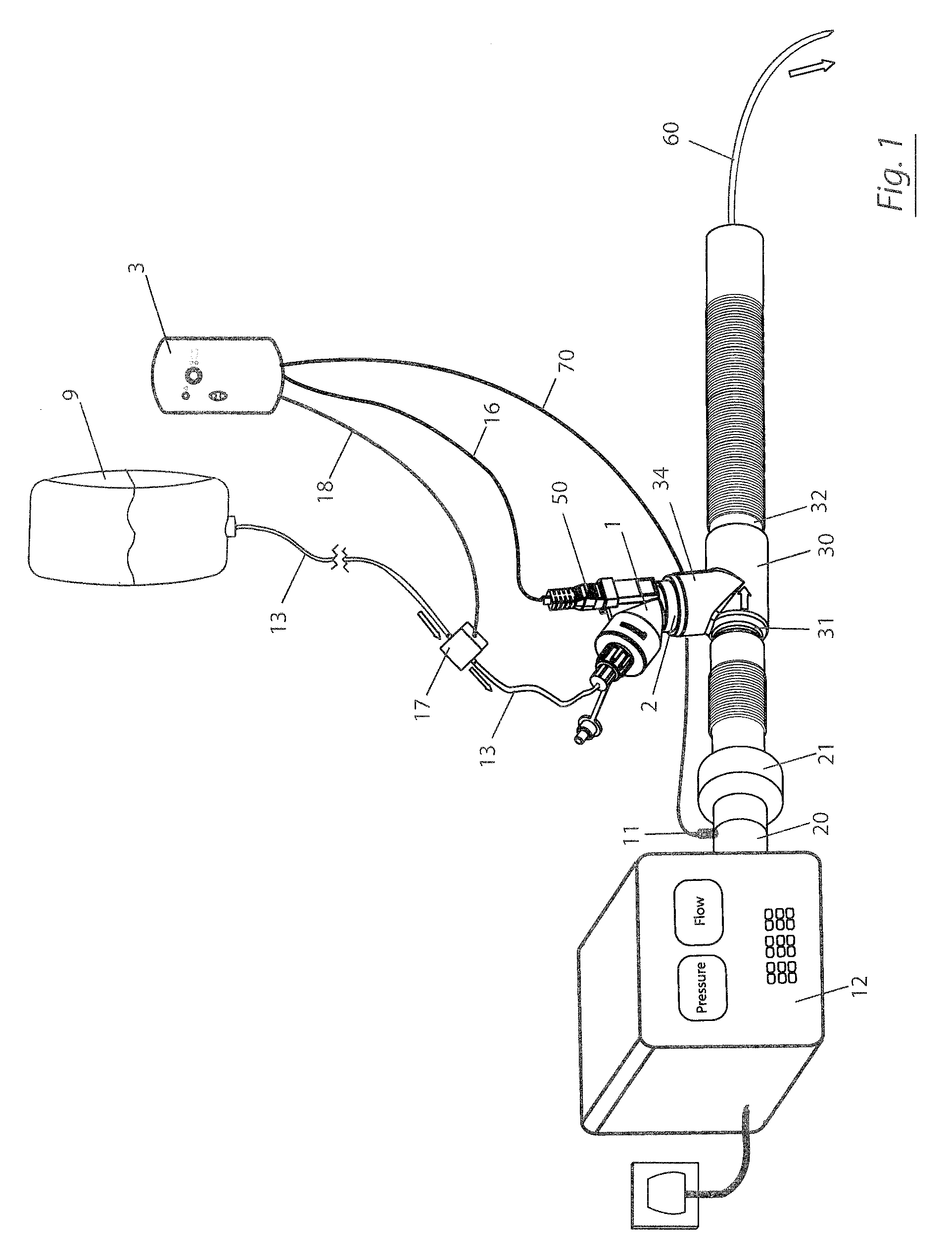 Insufflation of Body Cavities