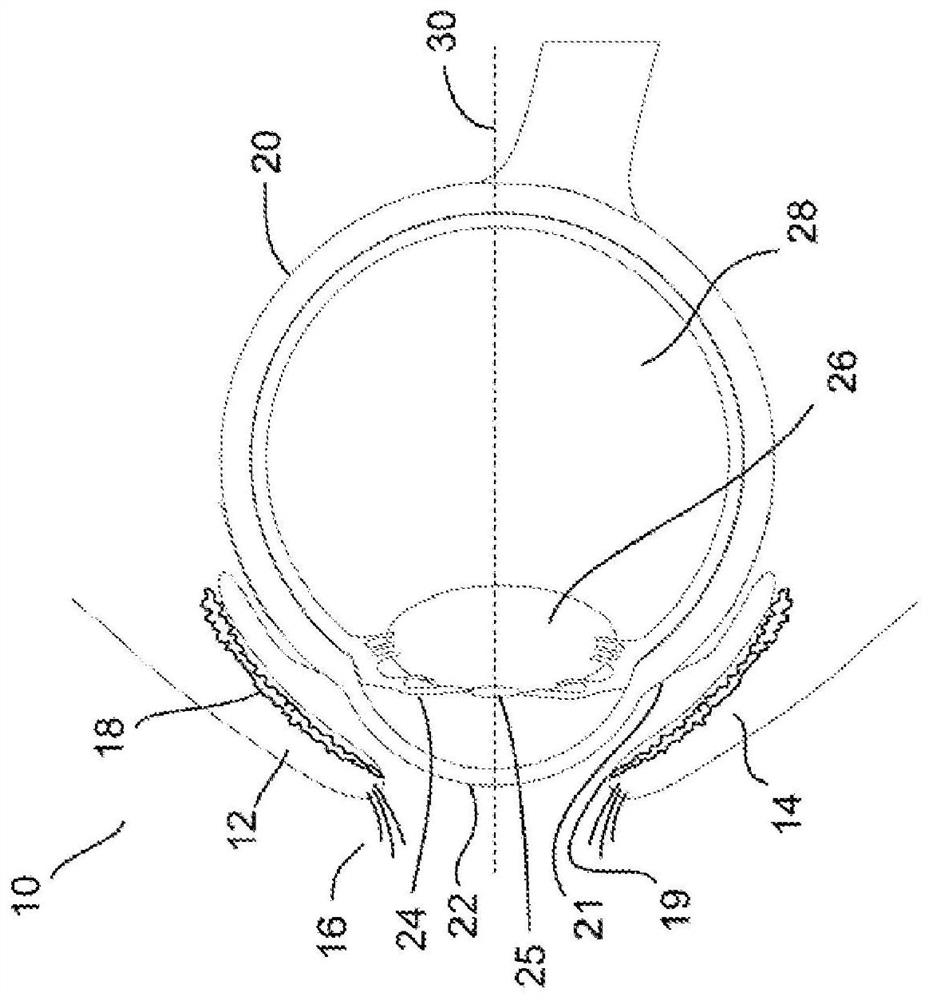 Systems and methods for the treatment of eye conditions