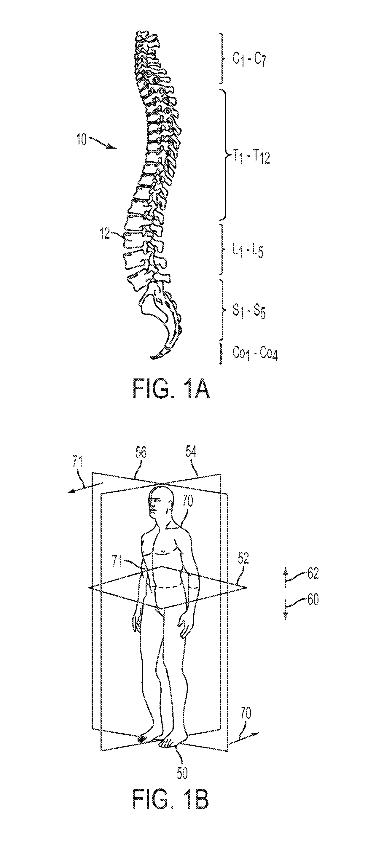 Apparatuses for externally controlling articulation of a joint motion