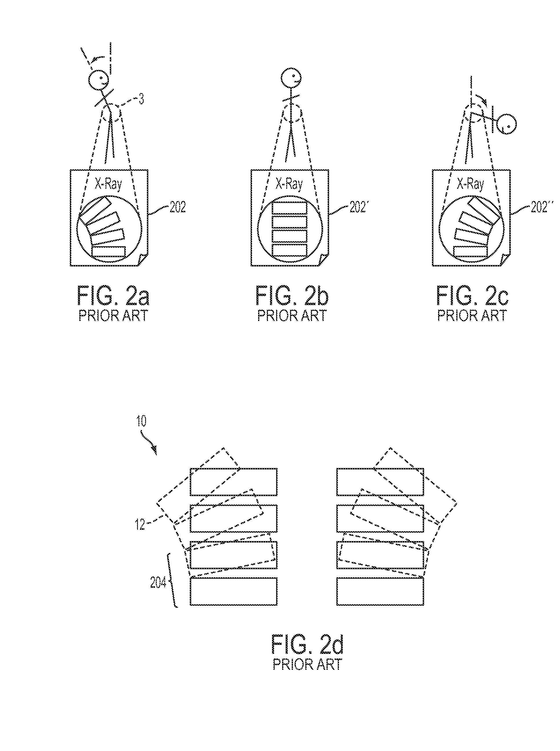 Apparatuses for externally controlling articulation of a joint motion