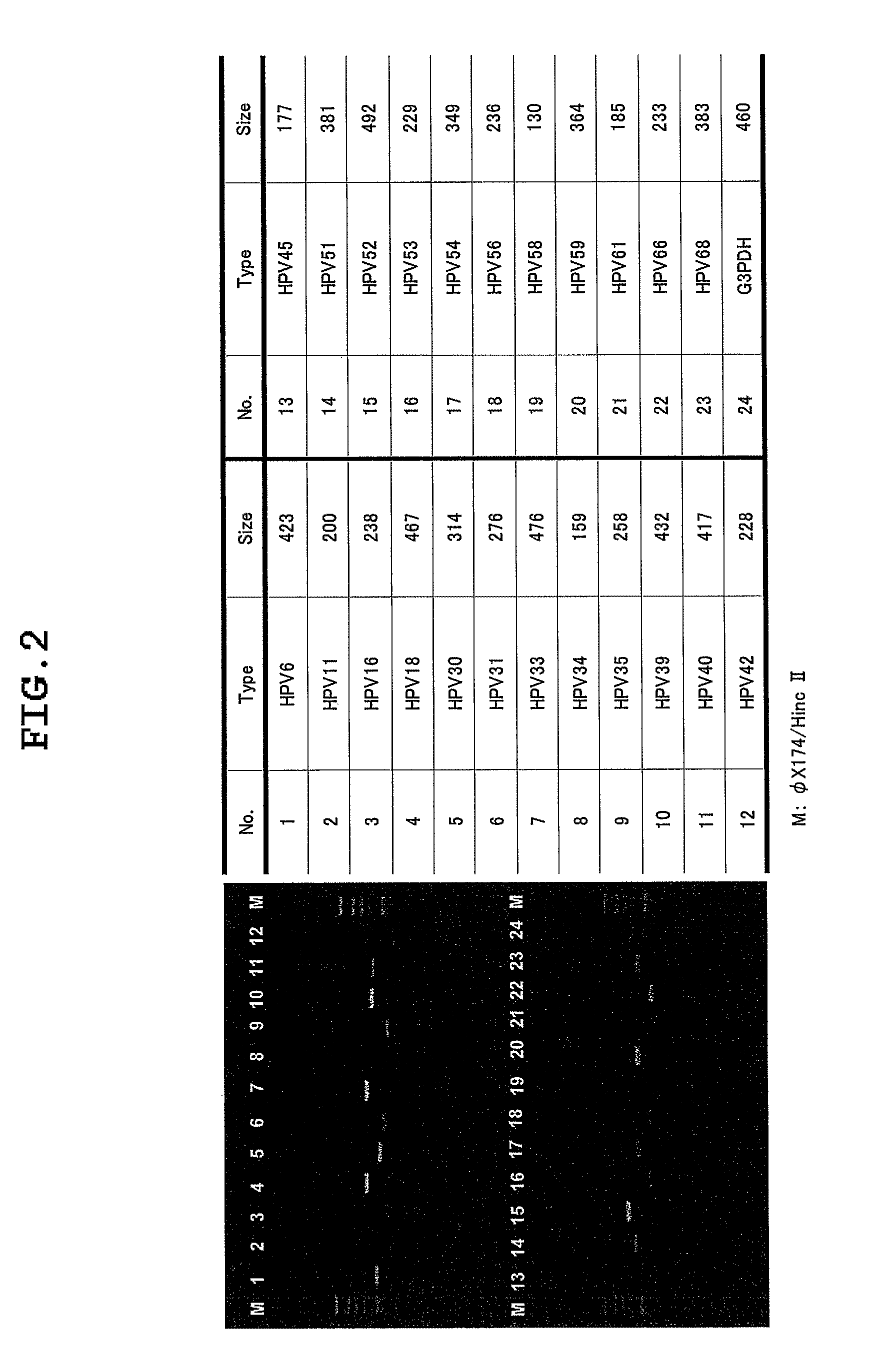 Primer set and probe for detection of human papillomavirus