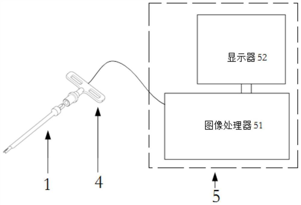 Intramedullary resetting device for thighbone