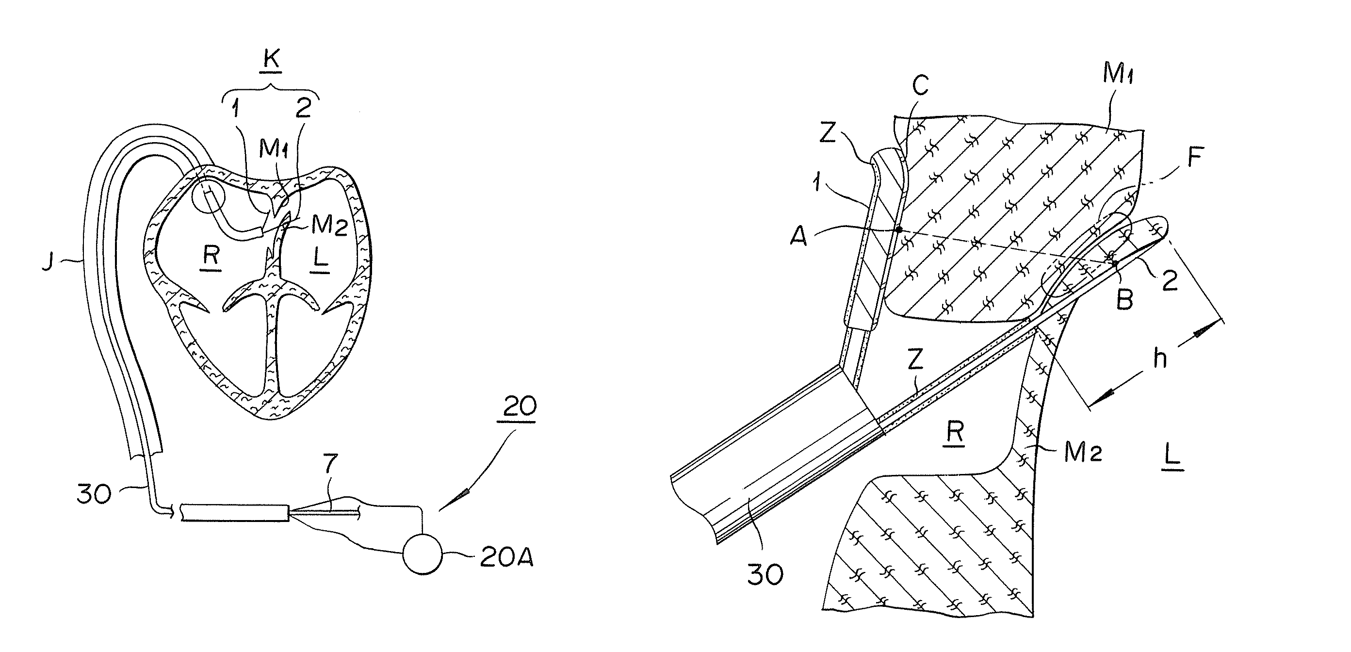 Medical device