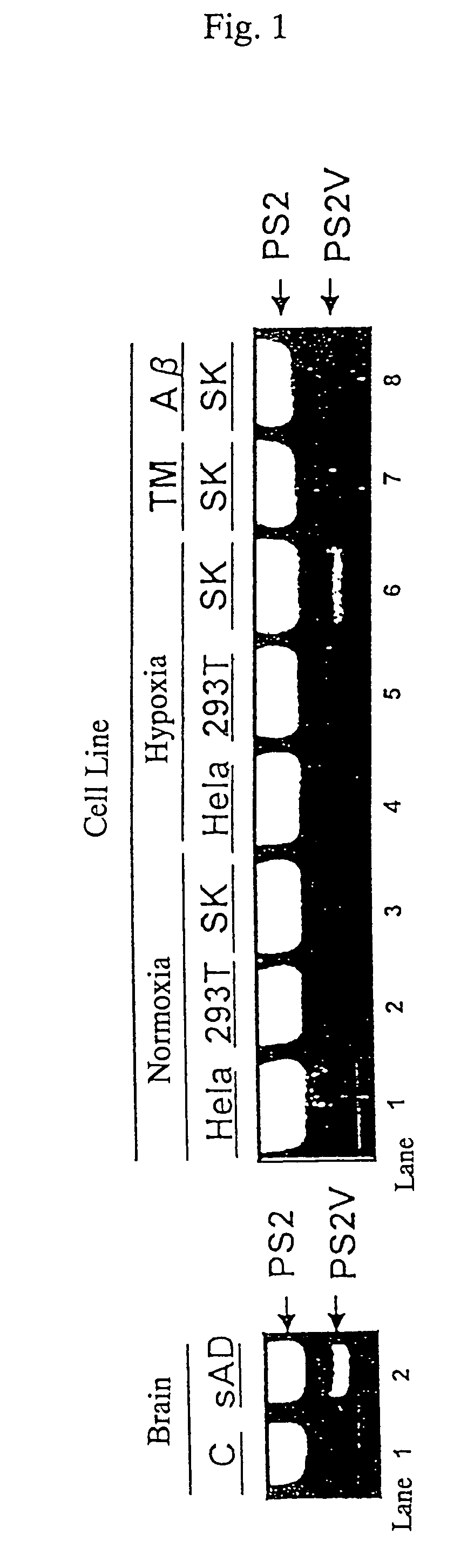 Nucleic acid participating in the formation of presenilin-2-gene exon 5 ...