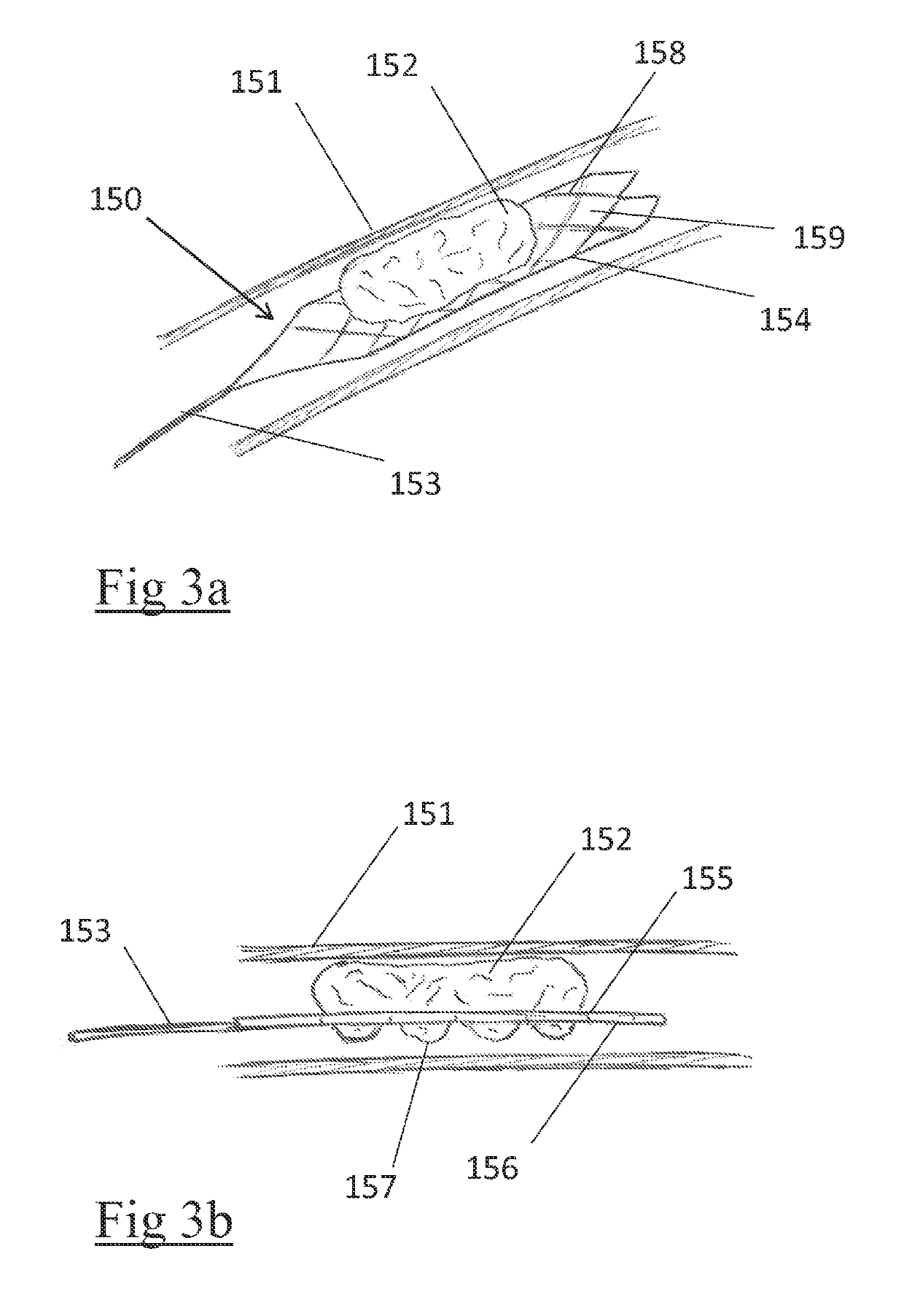 Clot retrieval device for removing occlusive clot from a blood vessel