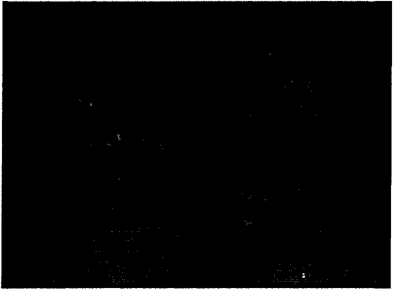 Medical degradable polyester asymmetric membrane and preparation method thereof