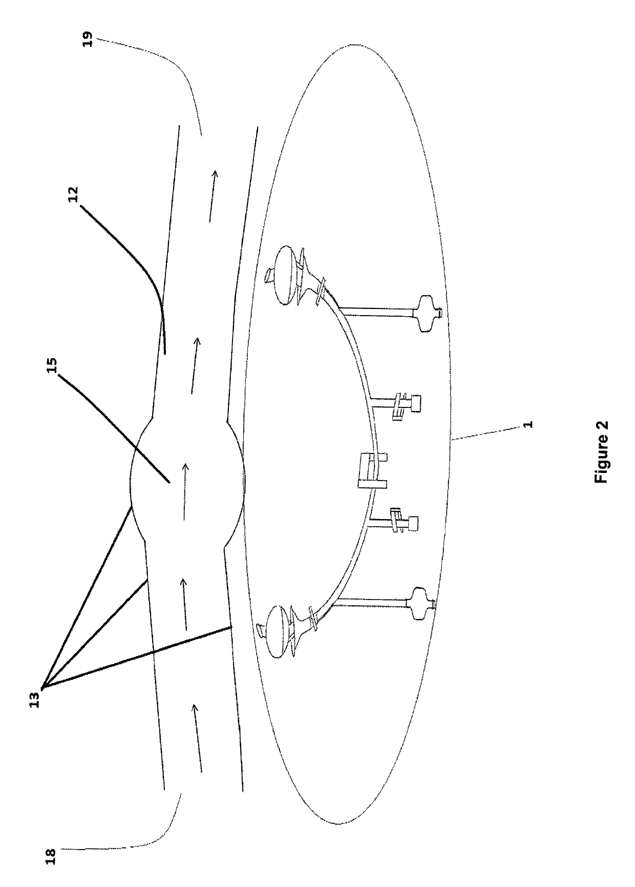 Catheter maintaining blood flow by vein bypass