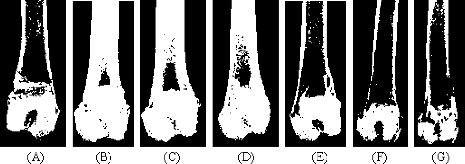 Calcium sulphate composite bone renovation material, preparation method and application thereof