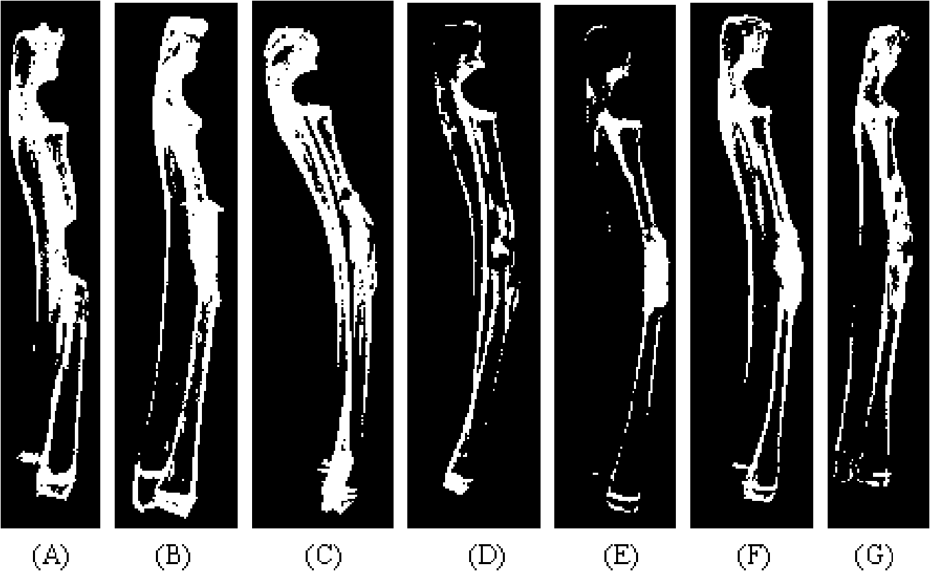 Calcium sulphate composite bone renovation material, preparation method and application thereof