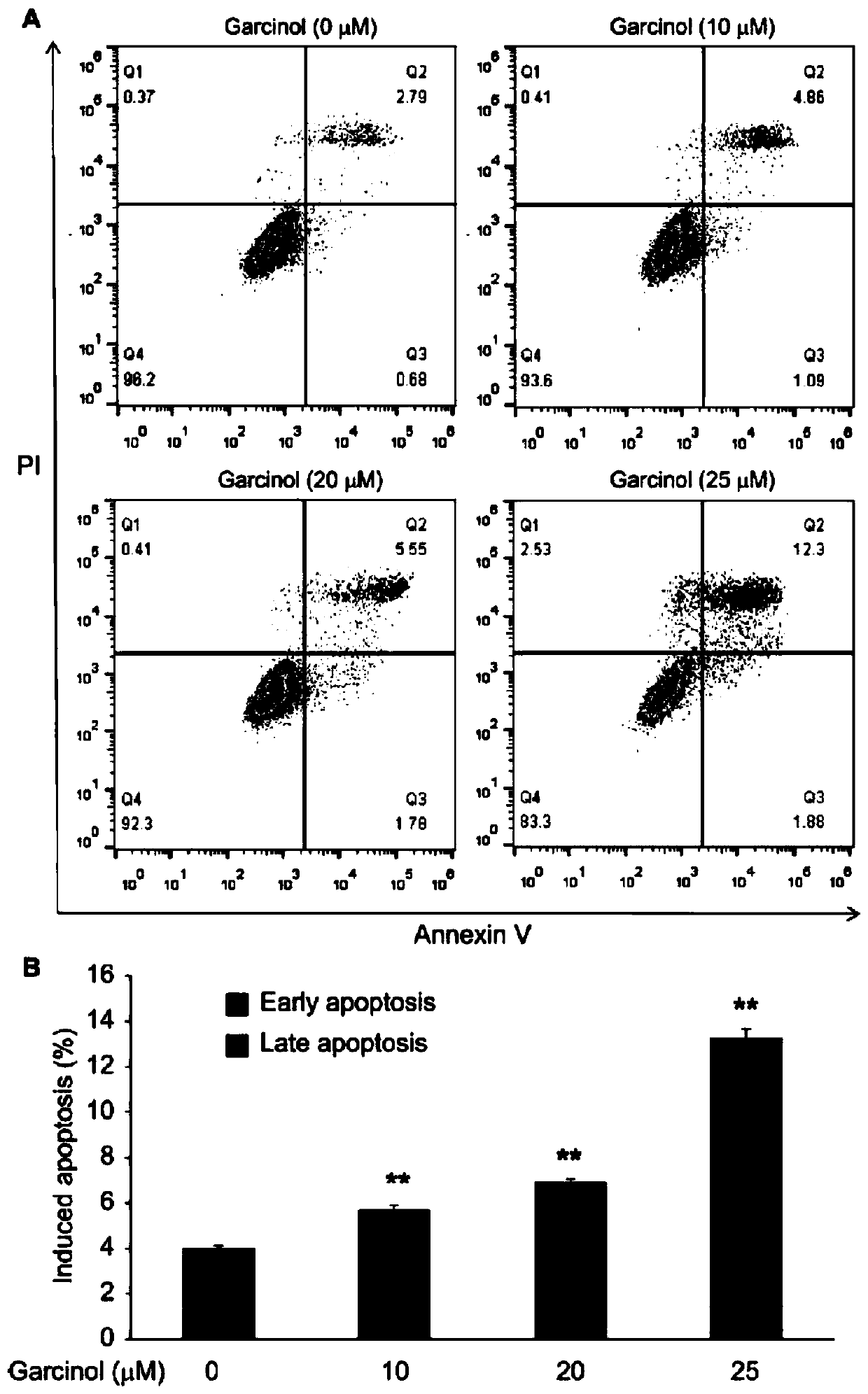 Anti-ovarian cancer medicinal composition with synergistic effect and application thereof