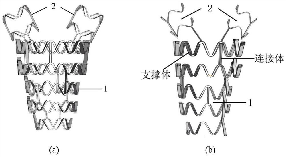 Degradable metal uterine cavity stent, release system and use method