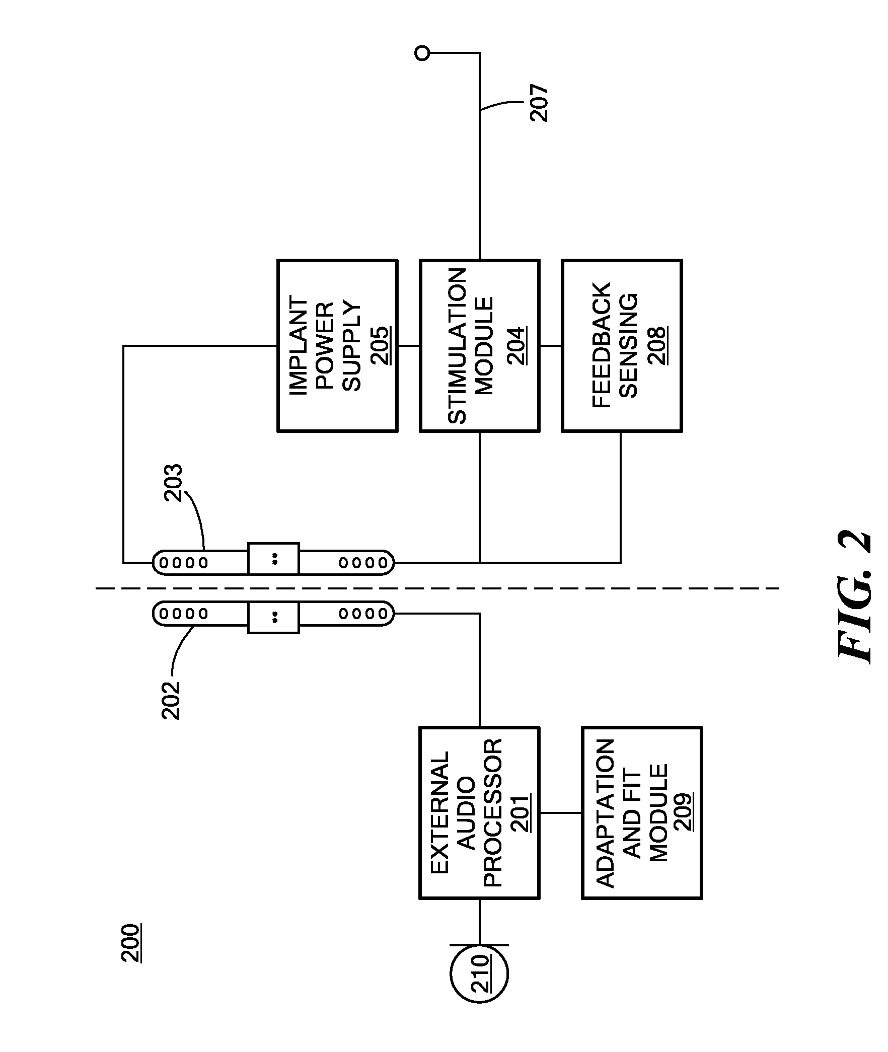 Cochlear Implant Pitch Intensity