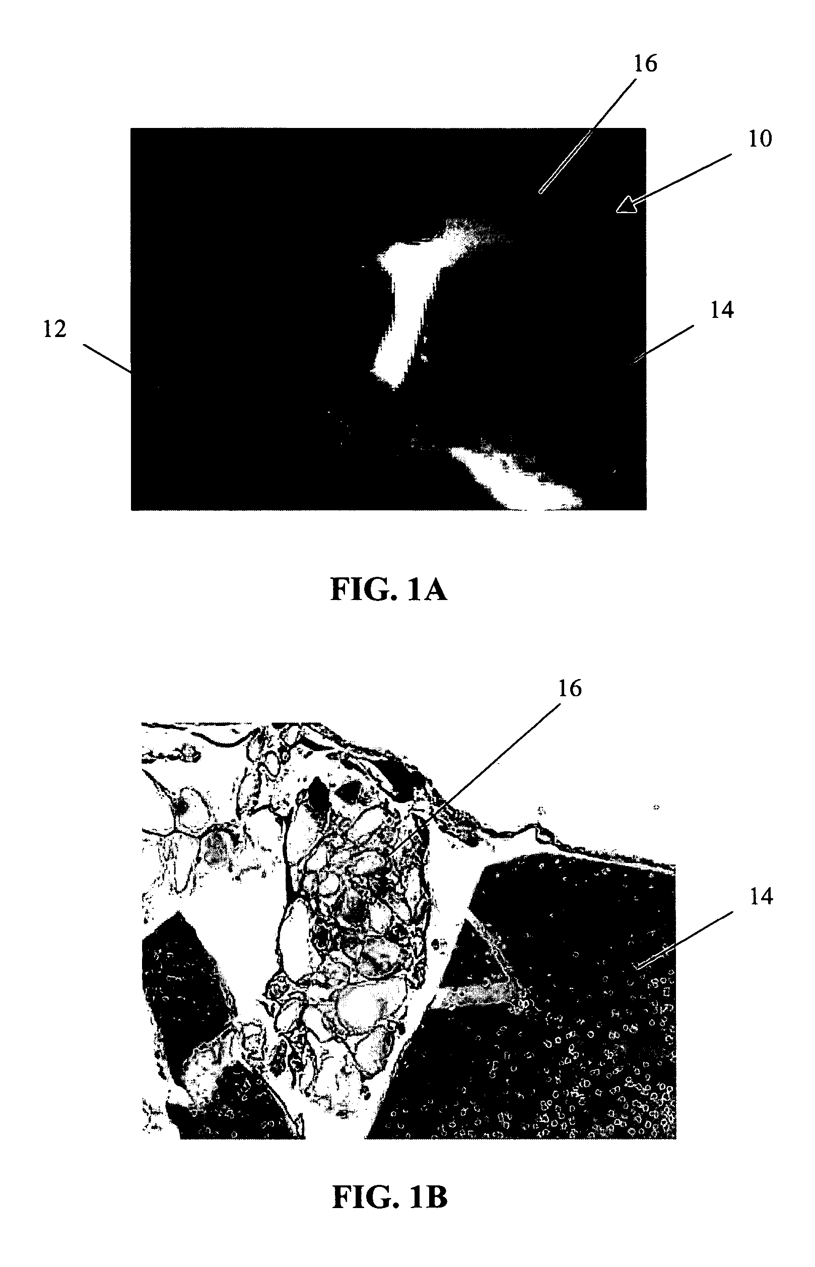 Conformable tissue repair implant capable of injection delivery