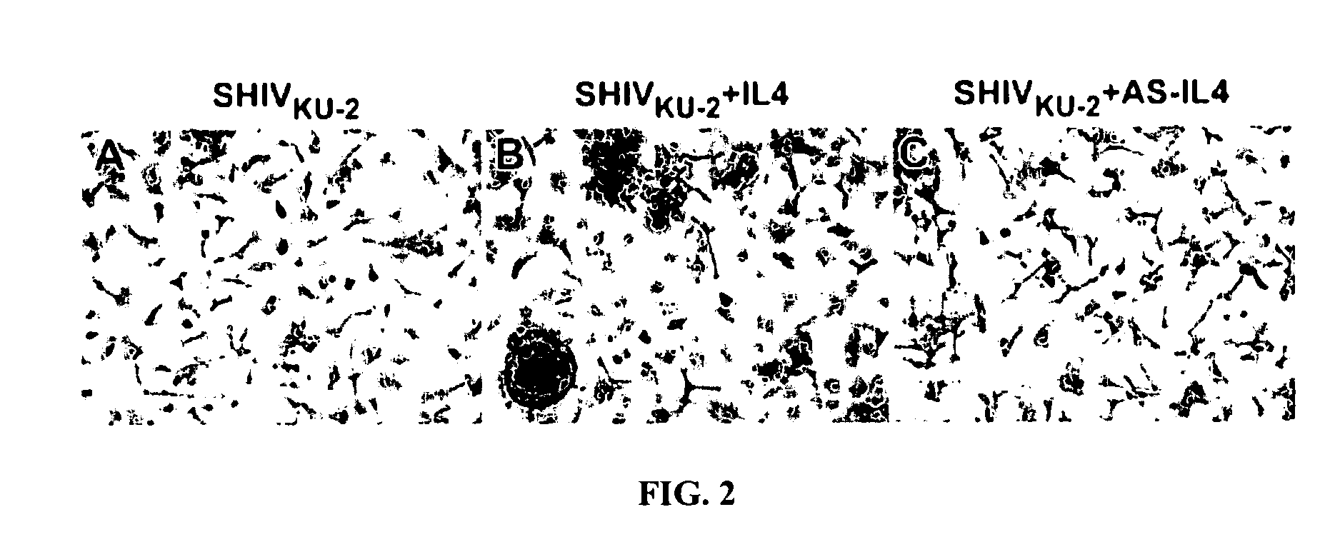 Inhibition of HIV and SHIV replication with antisense interleukin-4