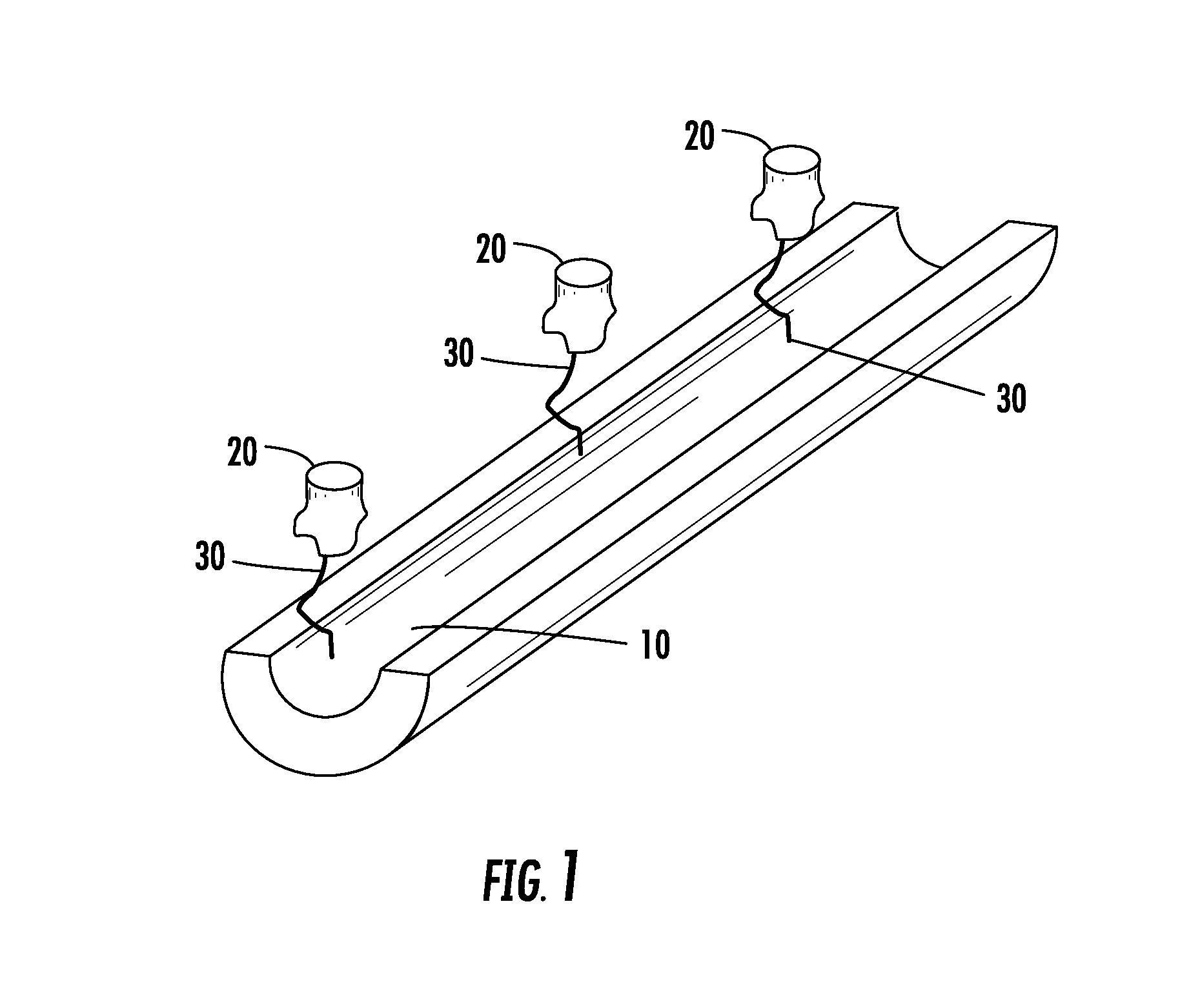 Methods and apparatus for kidney dialysis and extracorporeal detoxification