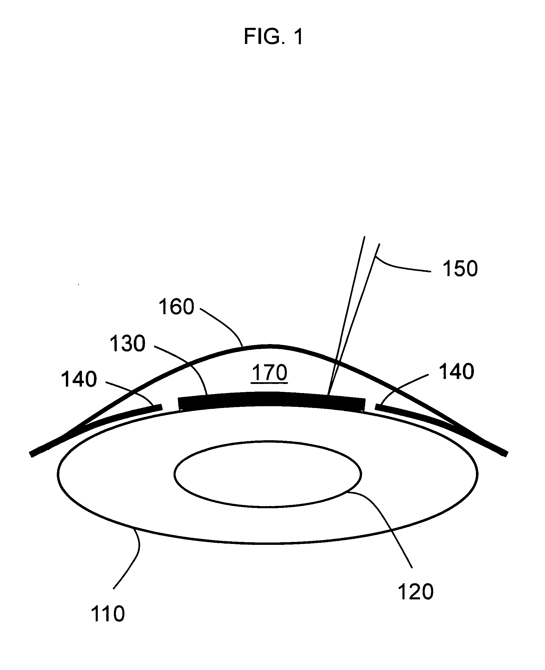 Laser-assisted thermal separation of tissue