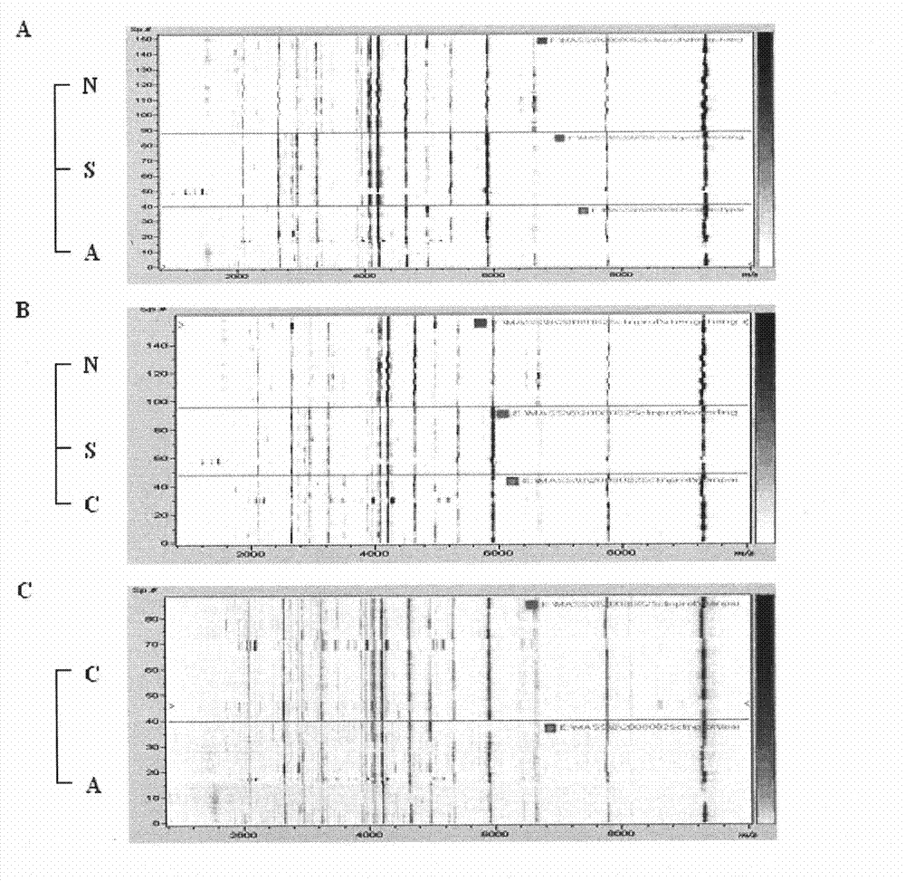 Method for detecting serum polypeptide for kidney transplantation rejection