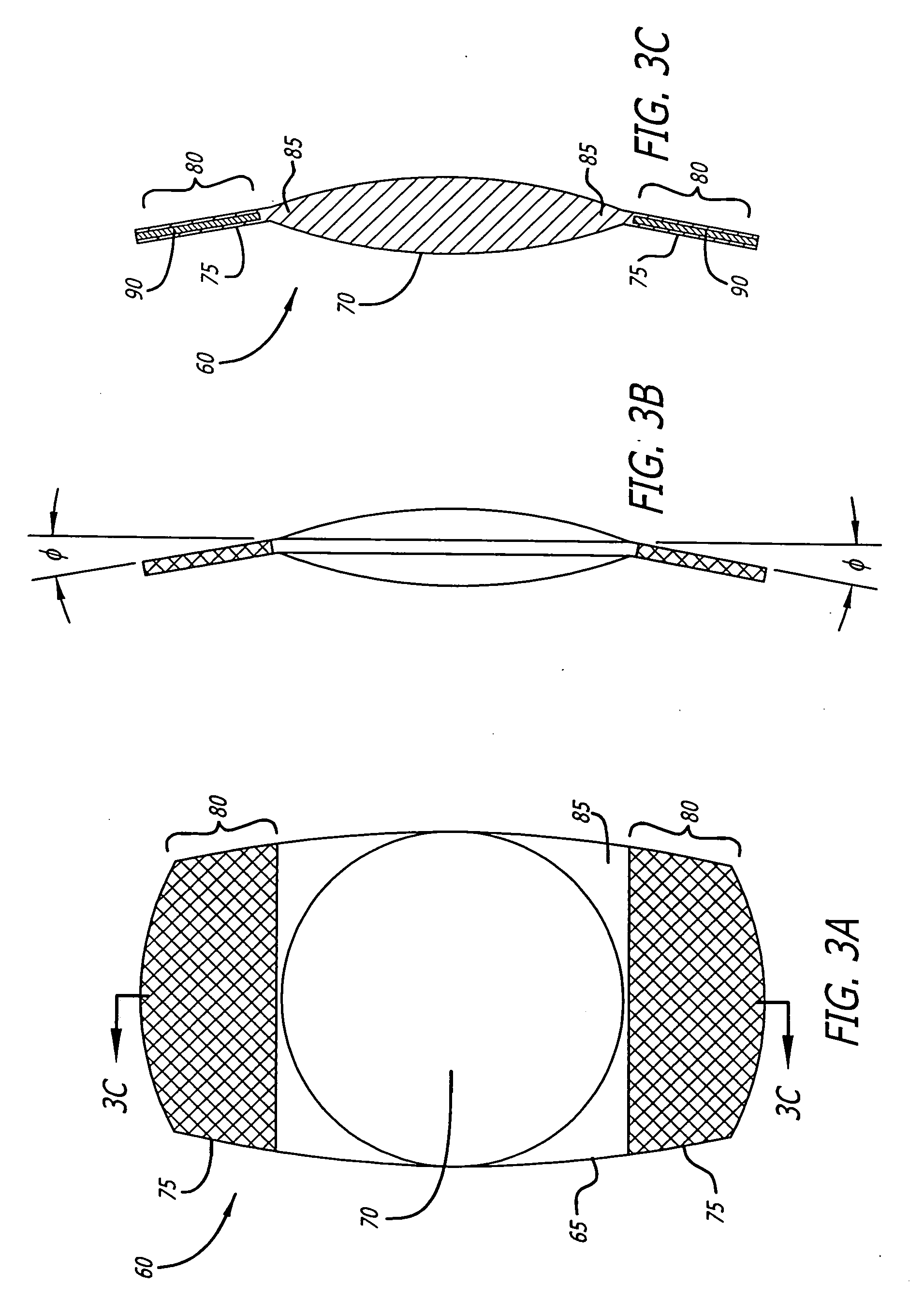 Accommodating intraocular lens with textured haptics