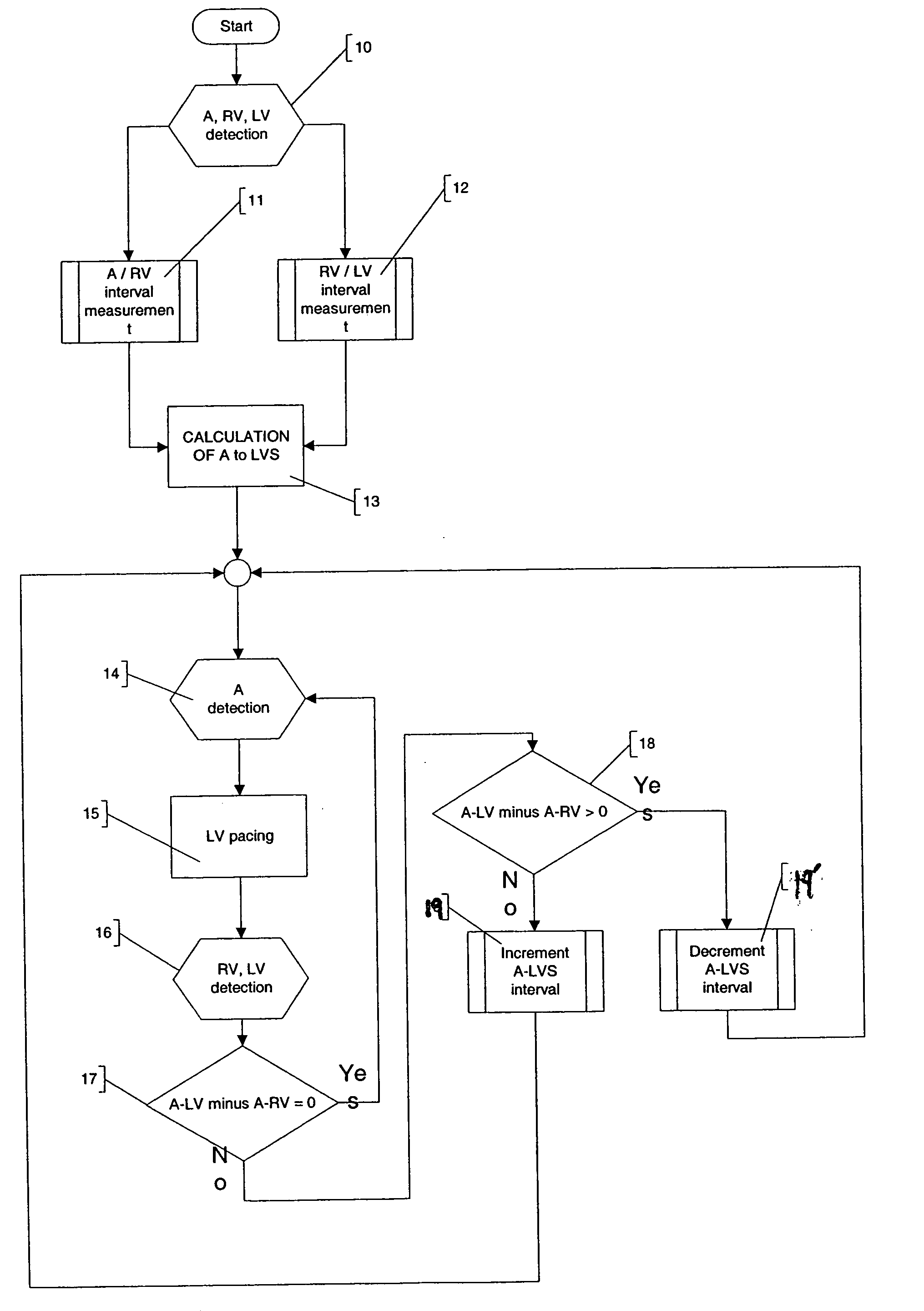 Mechanical sensing system for cardiac pacing and/or for cardiac resynchronization therapy