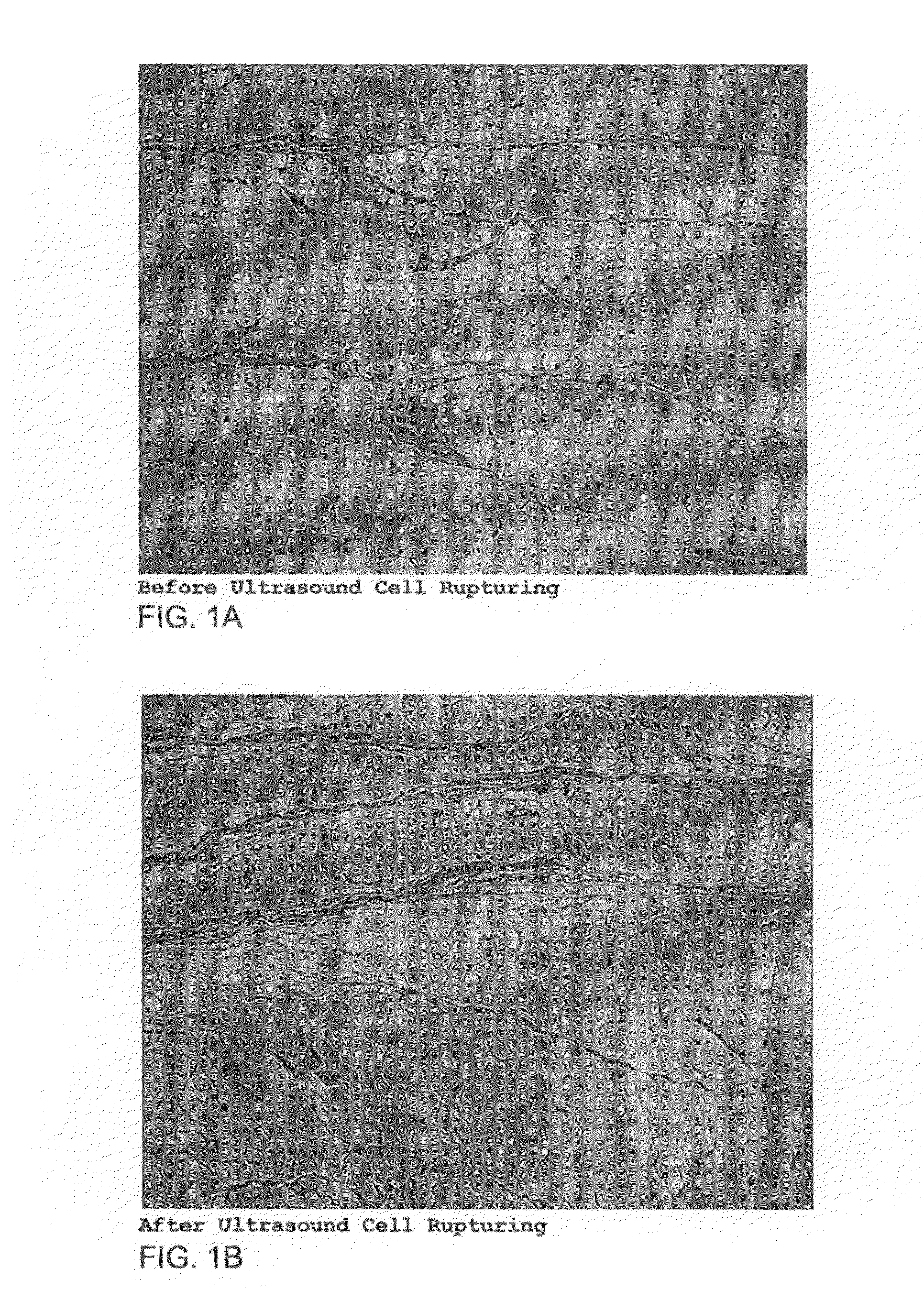 Apparatus and method for selective ultrasonic damage of adipocytes