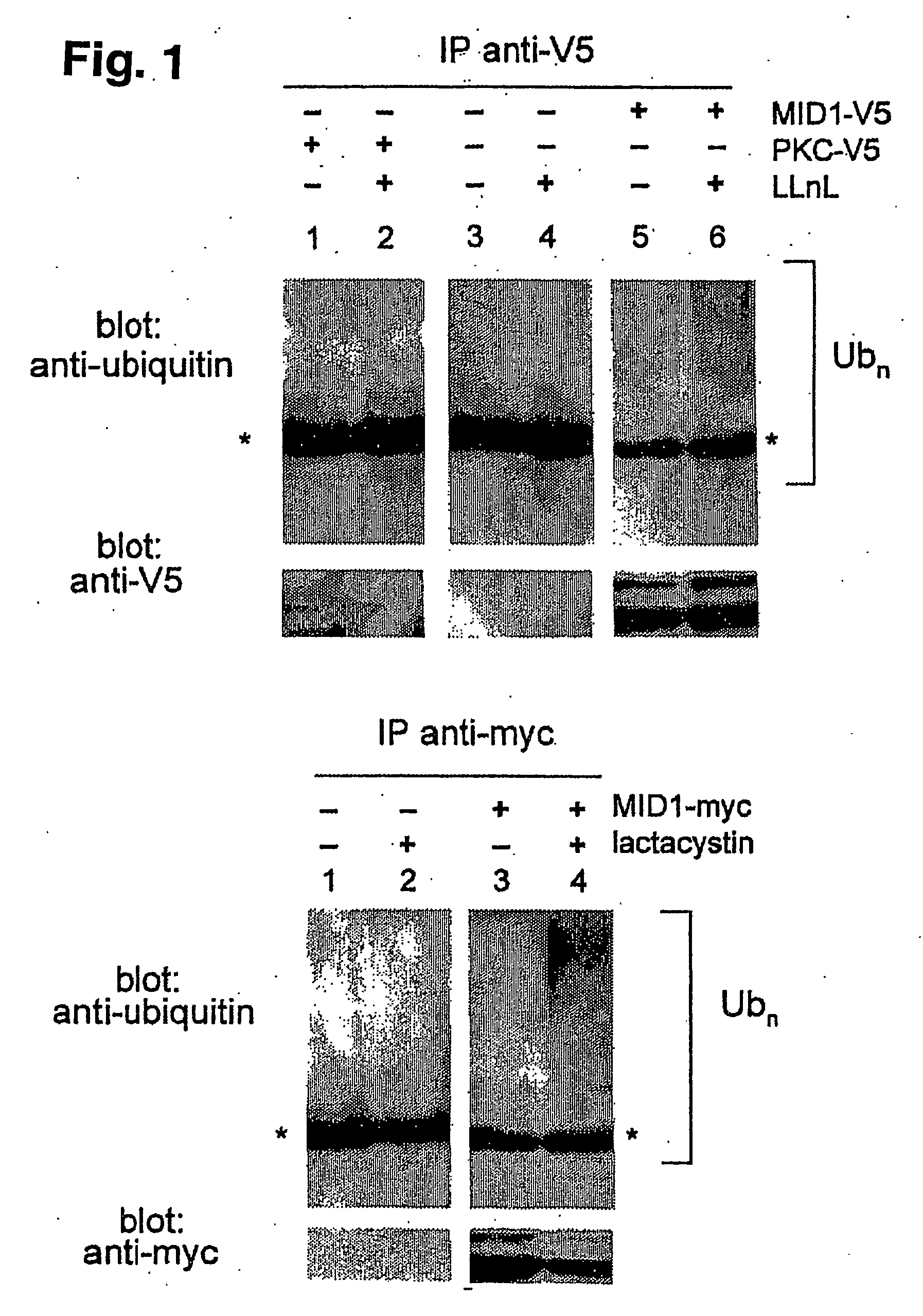 Means for use in treating diseases correlated with or caused by non-physiological levels of microtubule-associated pp2ac