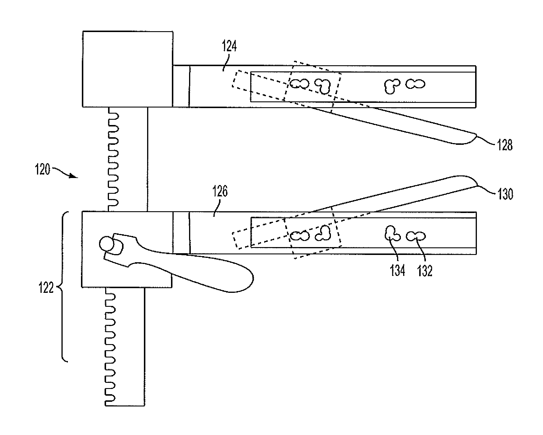 Sternal Retractor