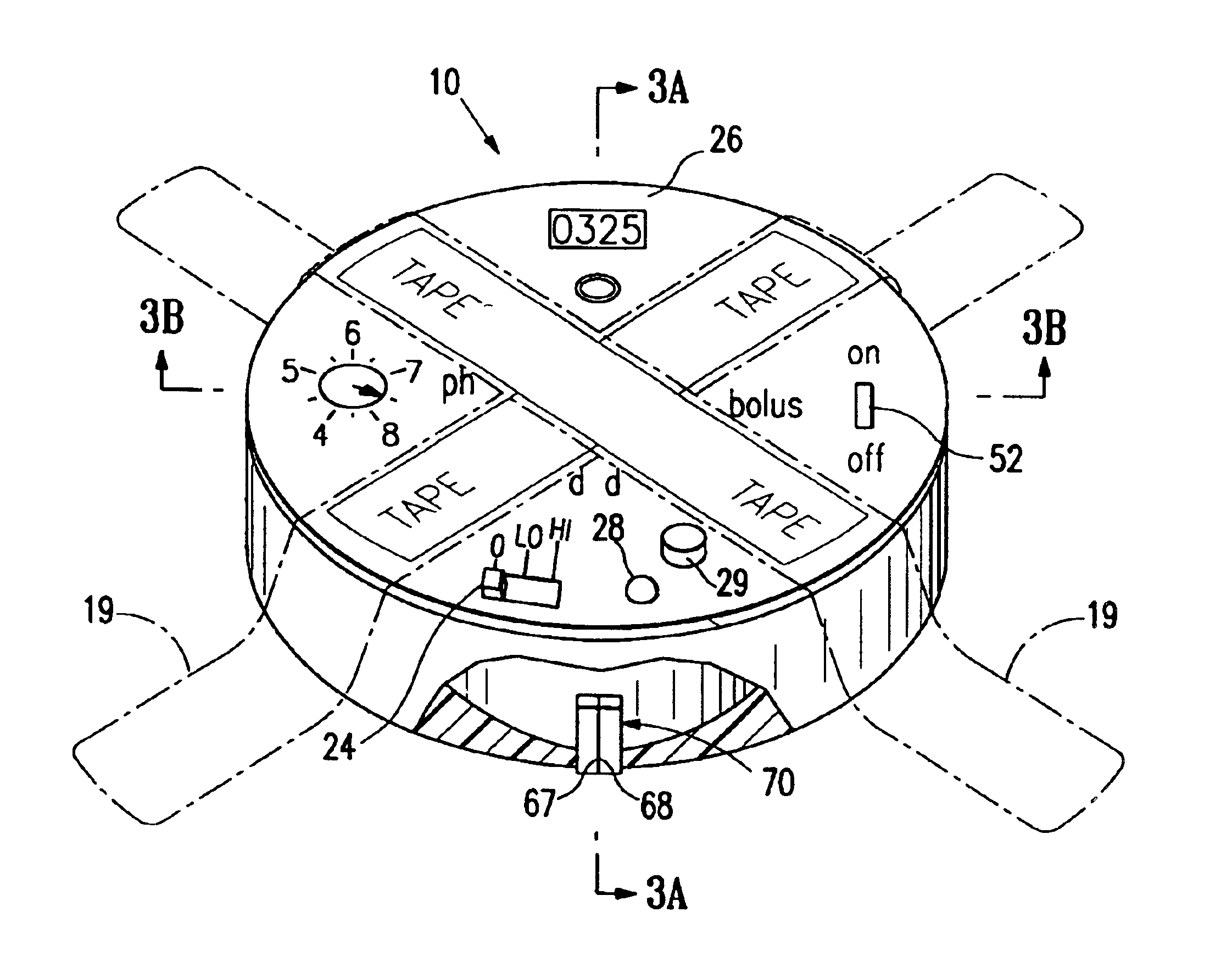 Sensor controlled analysis and therapeutic delivery system