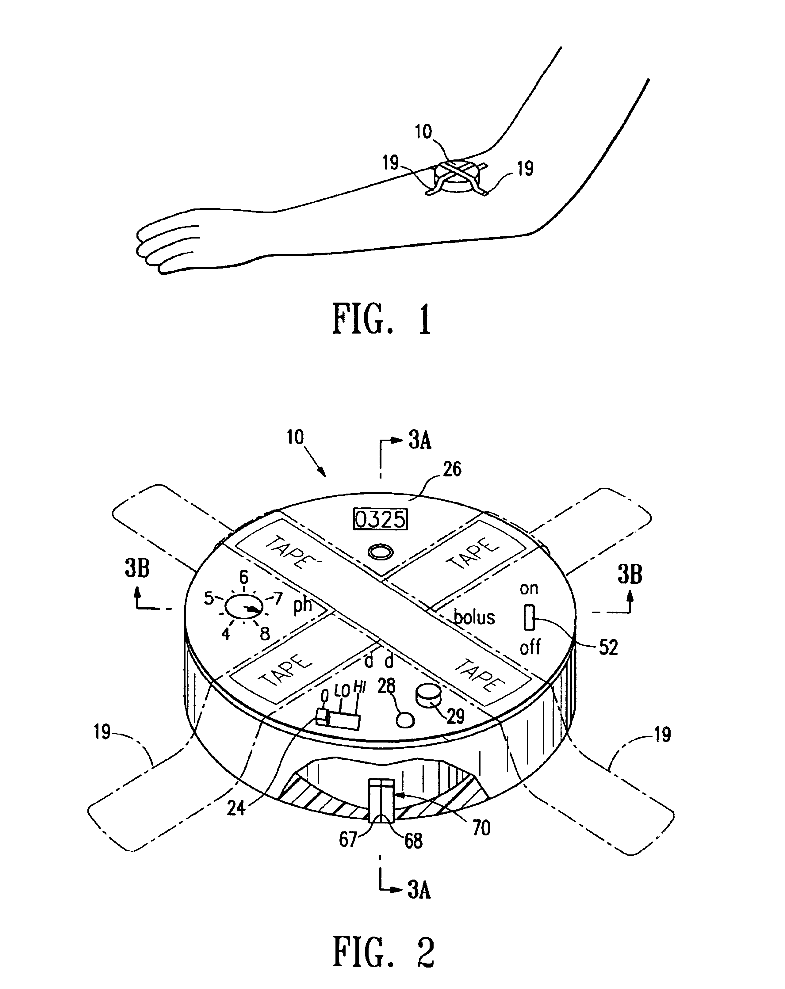 Sensor controlled analysis and therapeutic delivery system