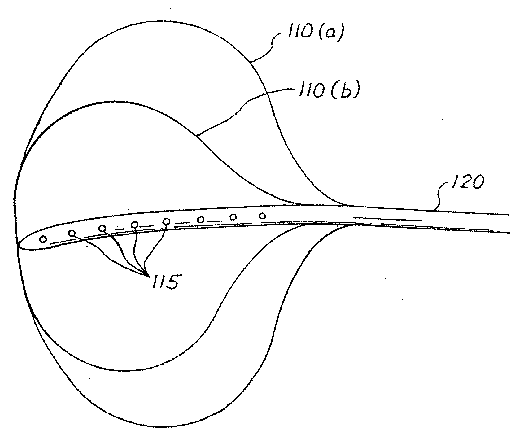 Balloon System and Methods for Treating Obesity